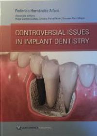 Controversial Issues in Implant Dentistry (FEDERICO HERNANDEZ ALFARO)