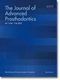 Effect of connector configuration on the fracture load in conventional and translucent zirconia three-unit fixed dental prostheses