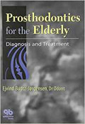 Prosthodontics for the Elderly: Diagnosis and Treatment