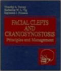 facial clefts and craniosynostosis. Principles and management