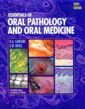 Essentials of Oral Pathology and Oral Medicine,6e (R.A. CAWSON, E.W. ODELL)