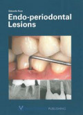Endo-Periodontal Lesions, 1e