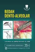 Bedah Dento Alveolar