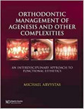Orthodontic Managment of Agnesis and other complextics