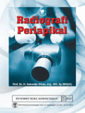 Radiografi Periapikal
