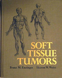 Image of Soft tissue tumors